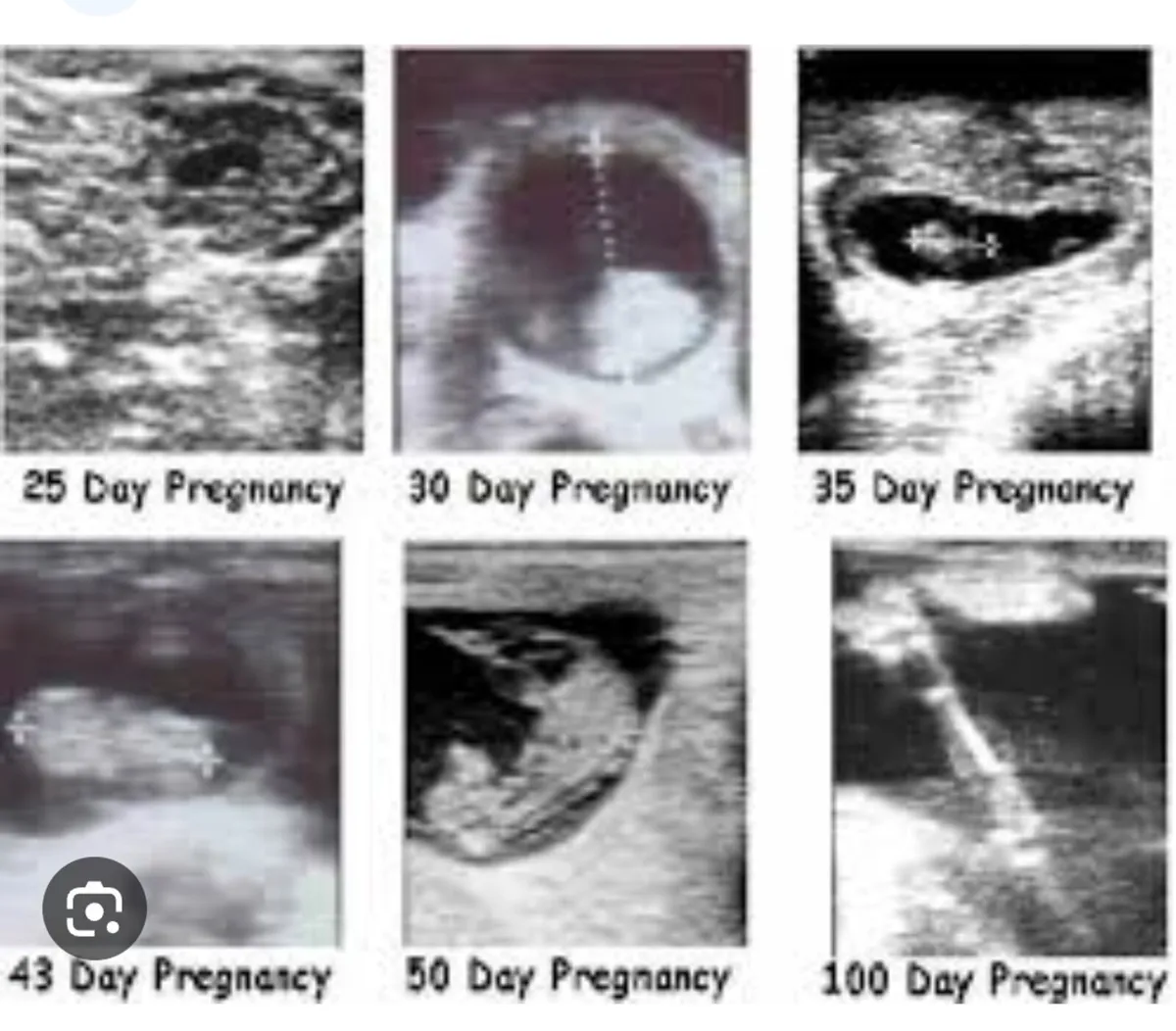 Pregnancy scanning  and farm service's - Image 3