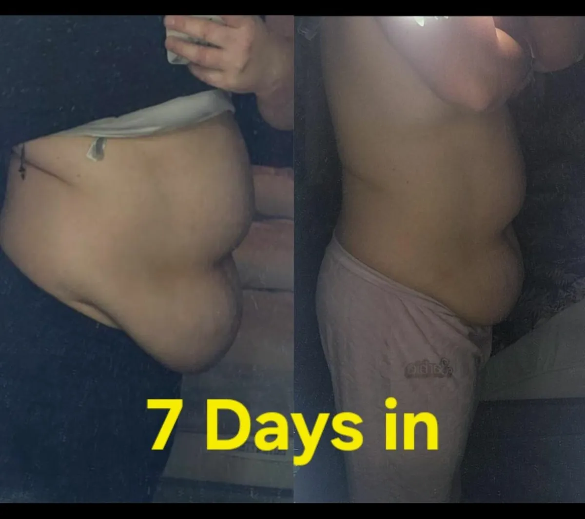 Weightloss the natural way - Image 1