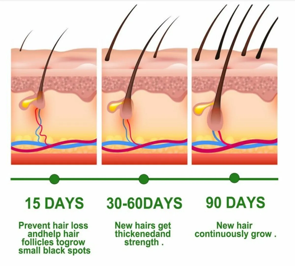 Pure Rosemary Essential Oil for Hair Growth, Skin - Image 2