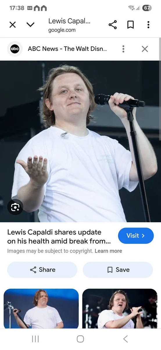 Lewis Capaldi Tickets Needed 🎟