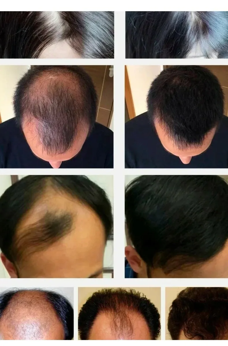 Hair growth oil - Image 2