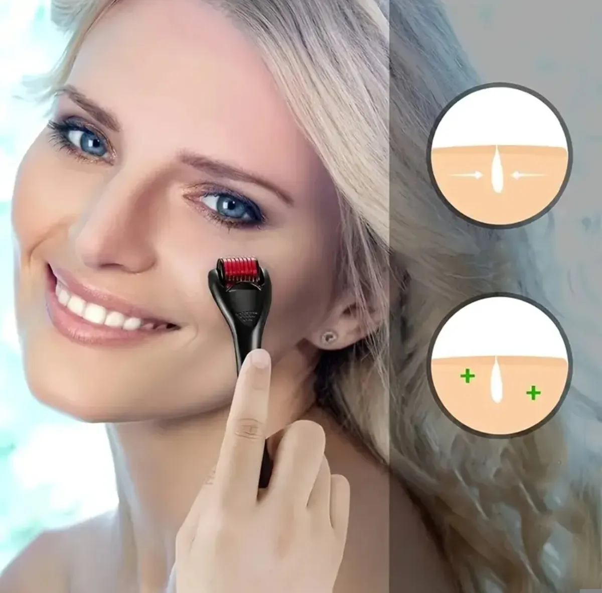 Derma Roller – Microneedling Tool | 0.25mm Needles - Image 1