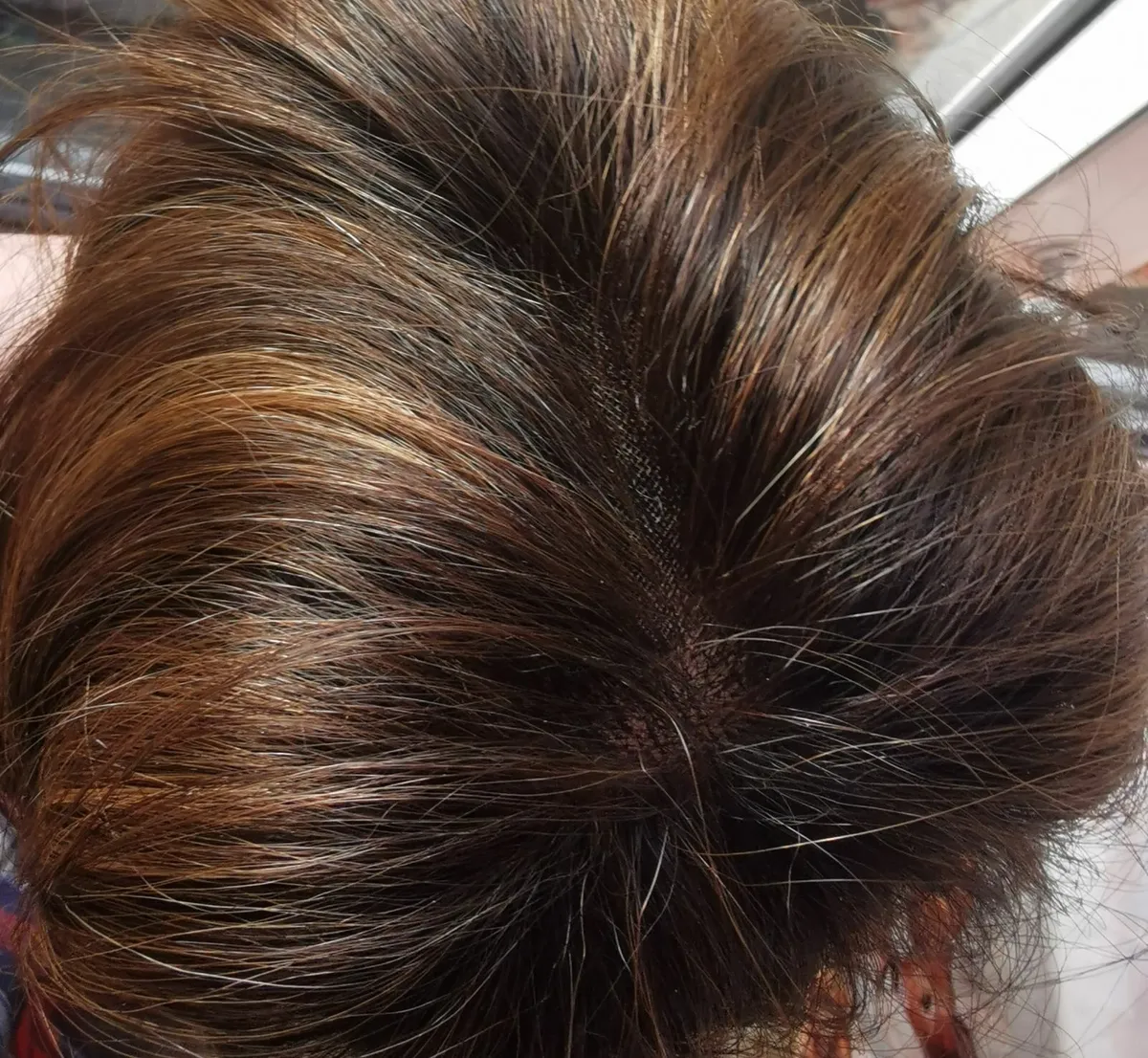 Hair topper - Image 2