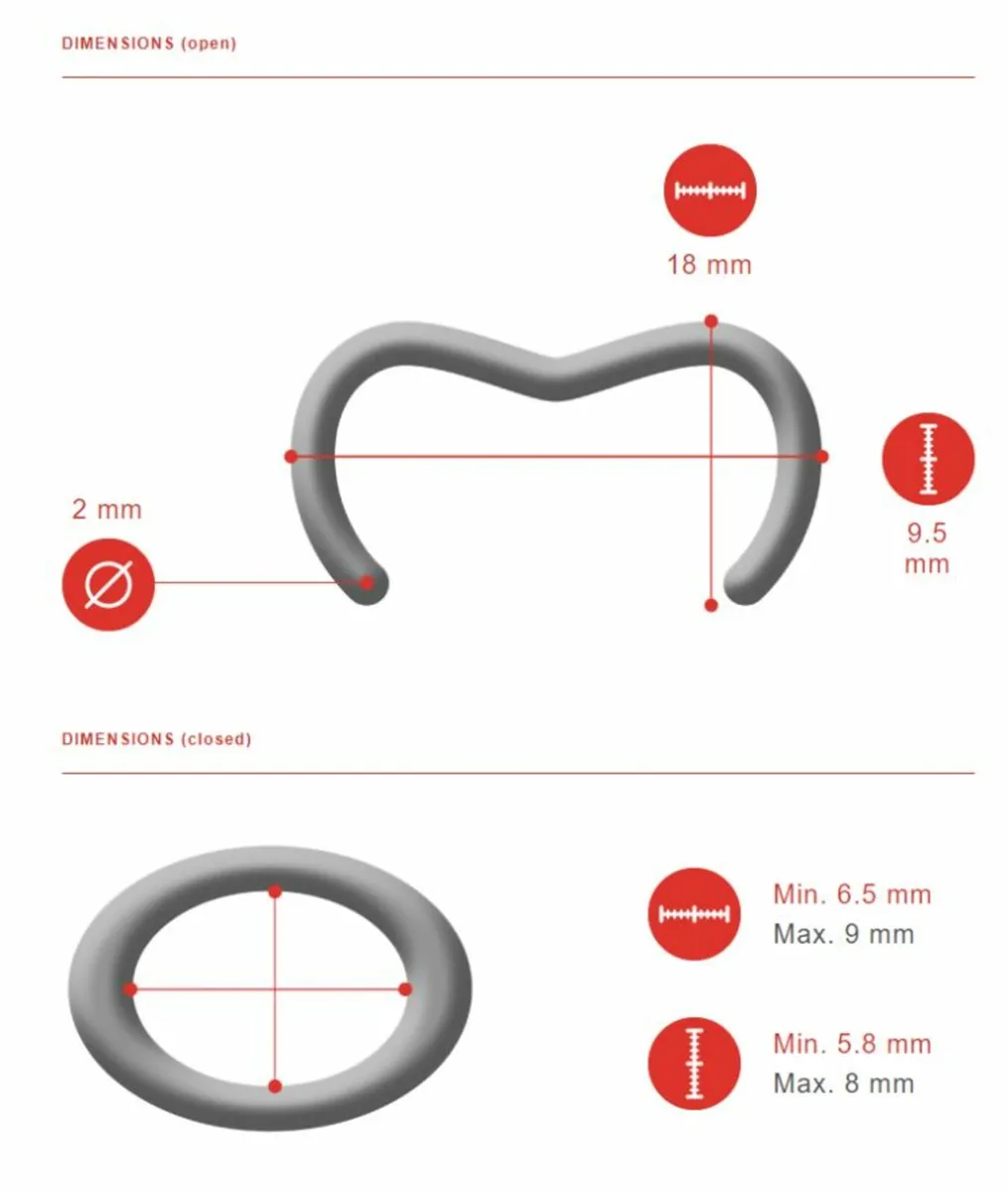 Top Nets for Poultry Pens, Wire Mesh & Clips - Image 3
