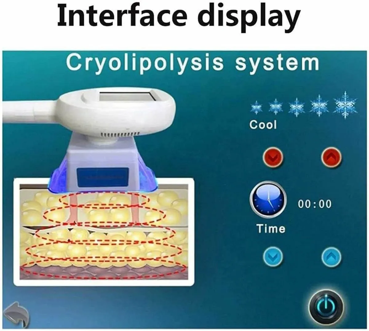 FAT FREEZING MACHINE....Machine Cryolipolysis..NEW - Image 4