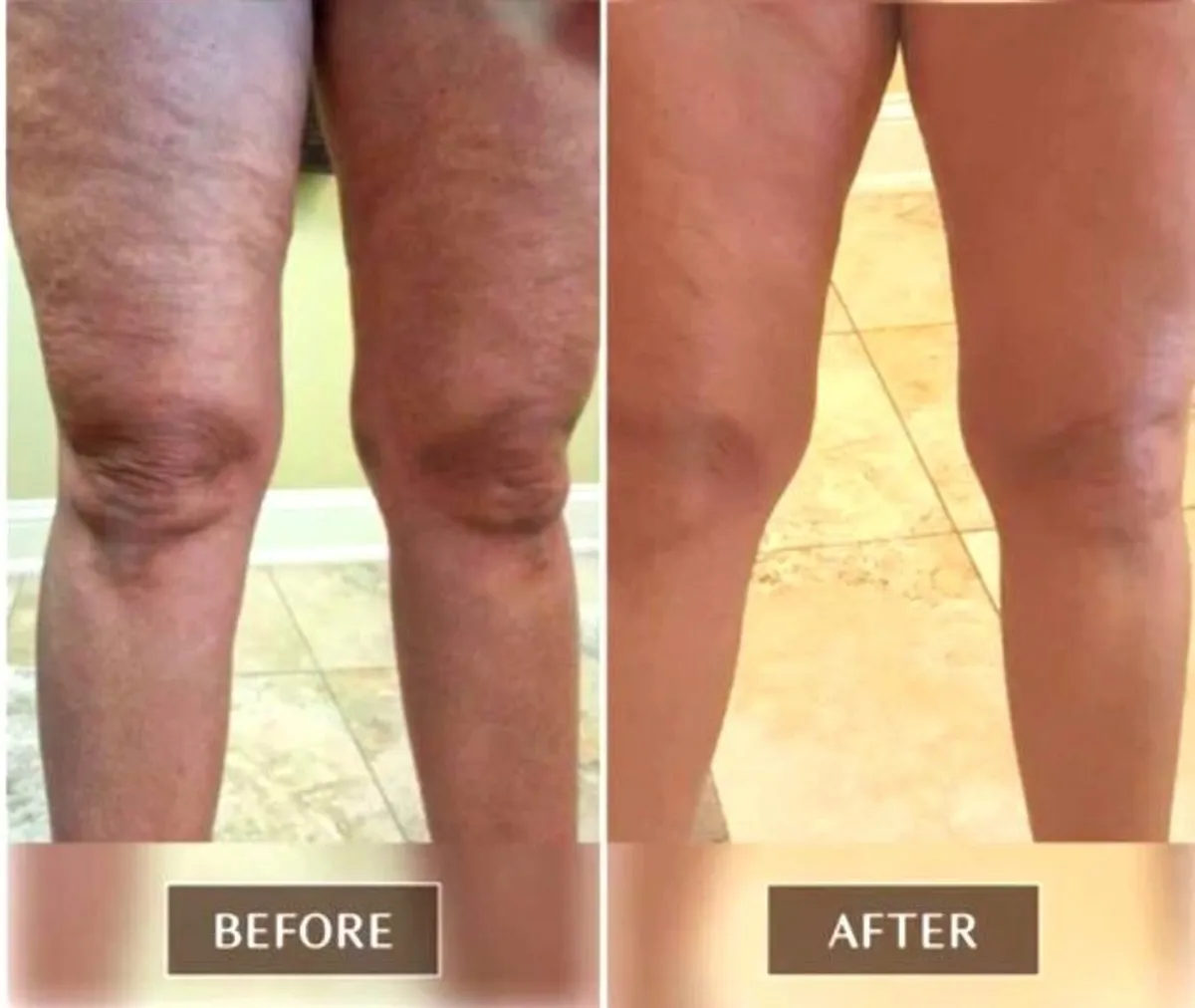 Excellent Proven FASCIA Release Tools Ashley Black - Image 1