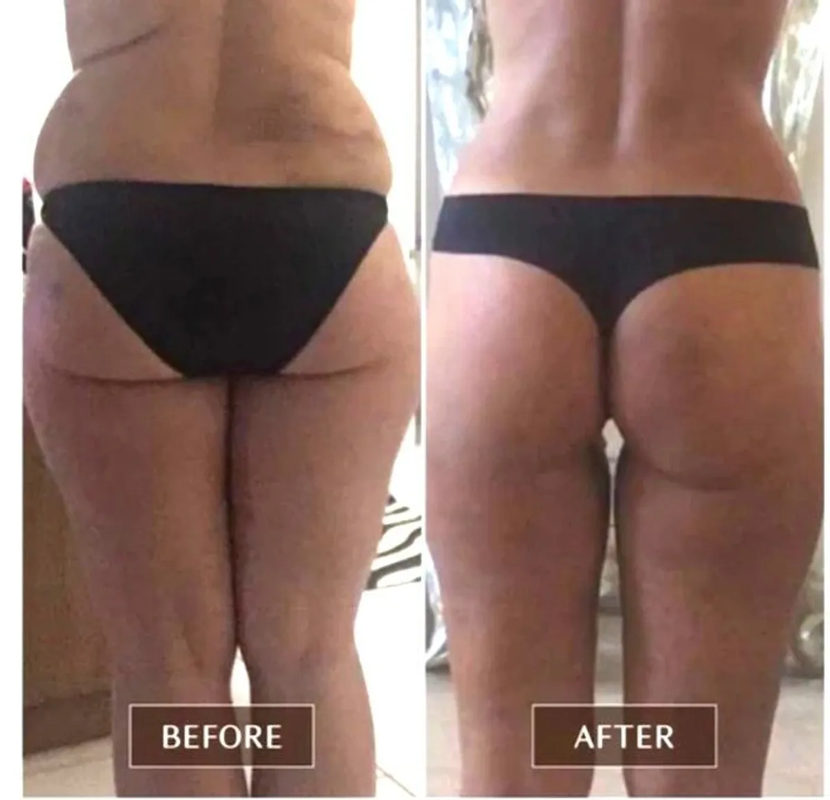 Excellent Proven FASCIA RELEASE Tools - Ashley Black - Image 1