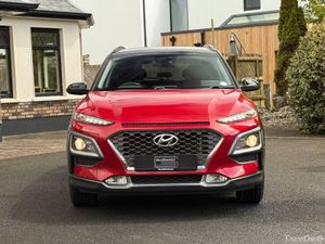 *70,000kms* One Owner Hyundai Kona! - Image 2