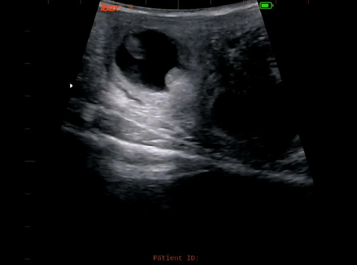 Cattle Scanning - Image 4