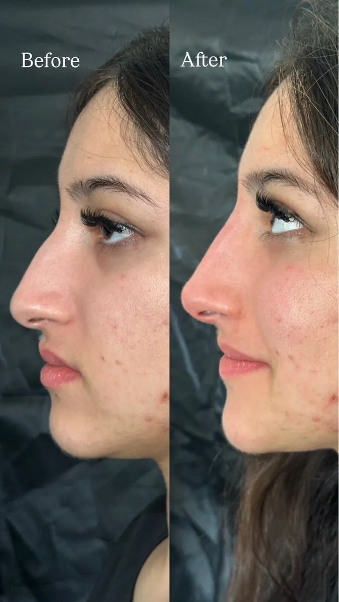 Facial harmonization - Image 2
