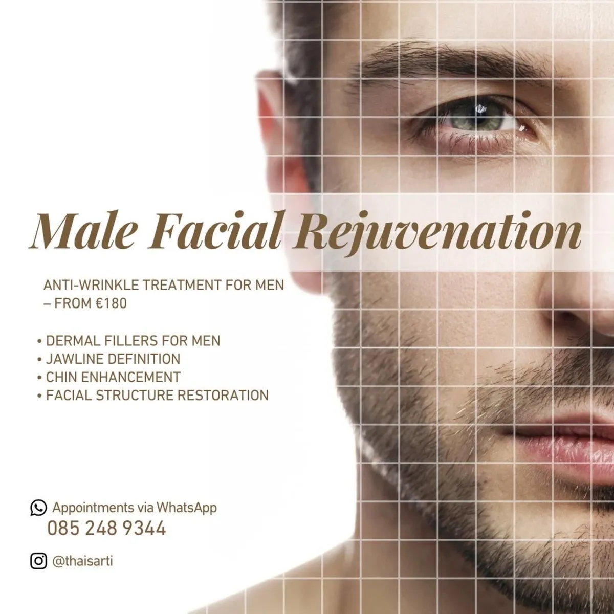 Facial harmonization - Image 3