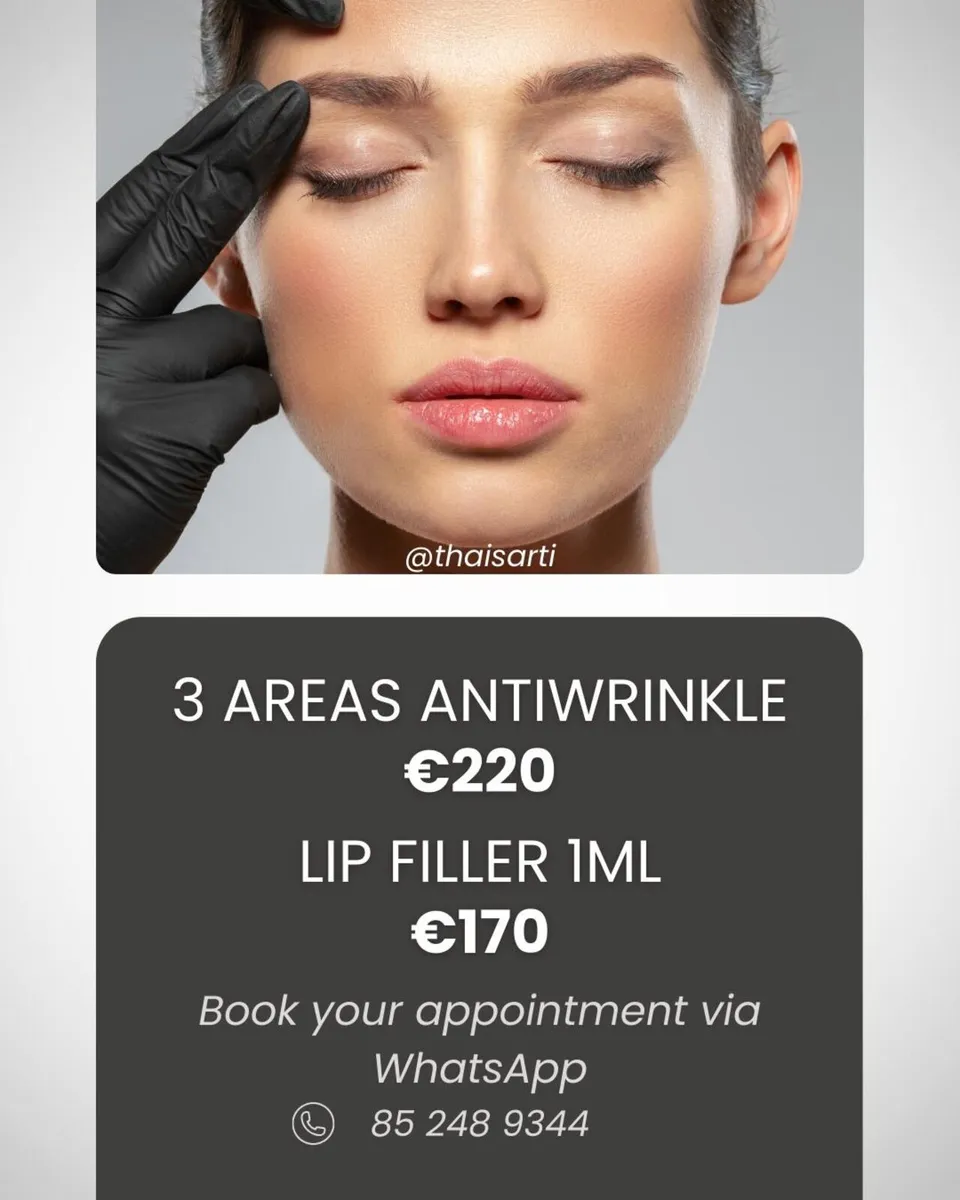 Facial harmonization - Image 4