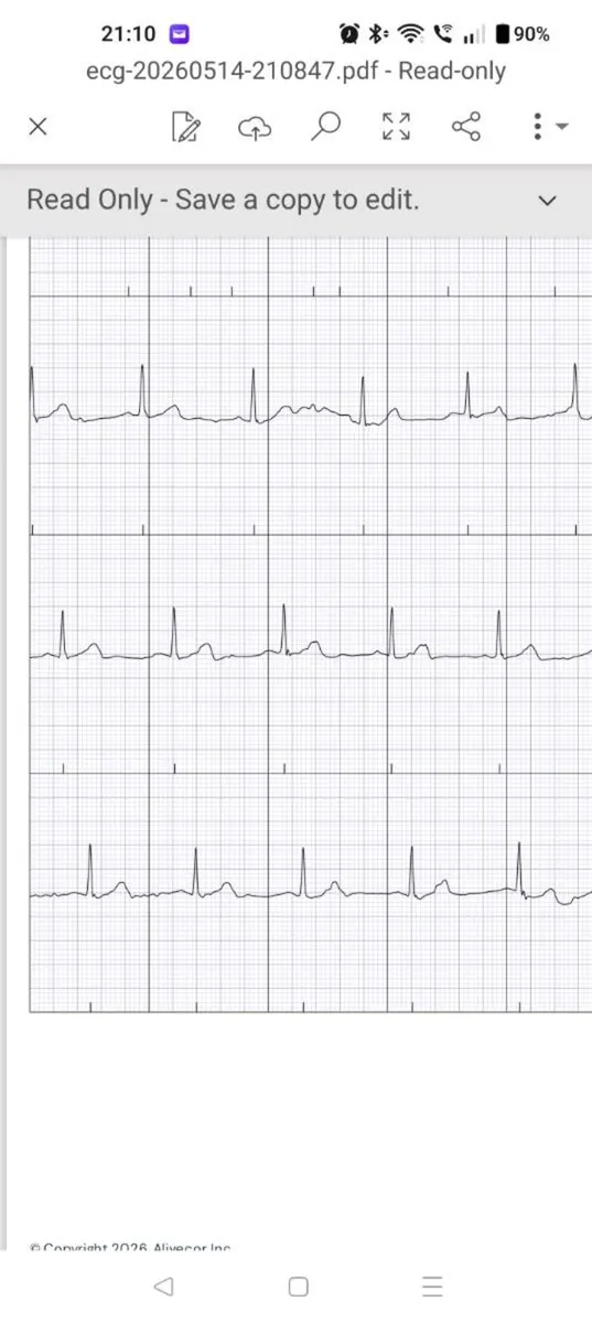 Kardia Mobile ECG - Image 4