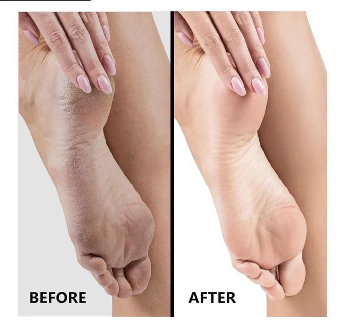 SlkySmooth 3-in-1 Foot File Pumice Stone Hard Skin - Image 4