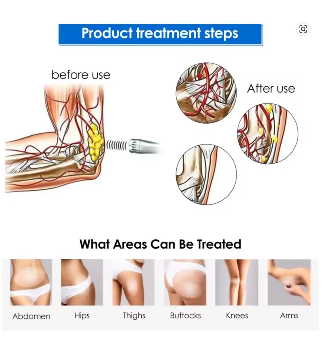 Touch Screen Shockwave Therapy Machine - Image 3