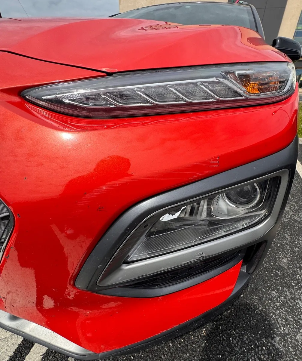 2018 Hyundai Kona - Image 4