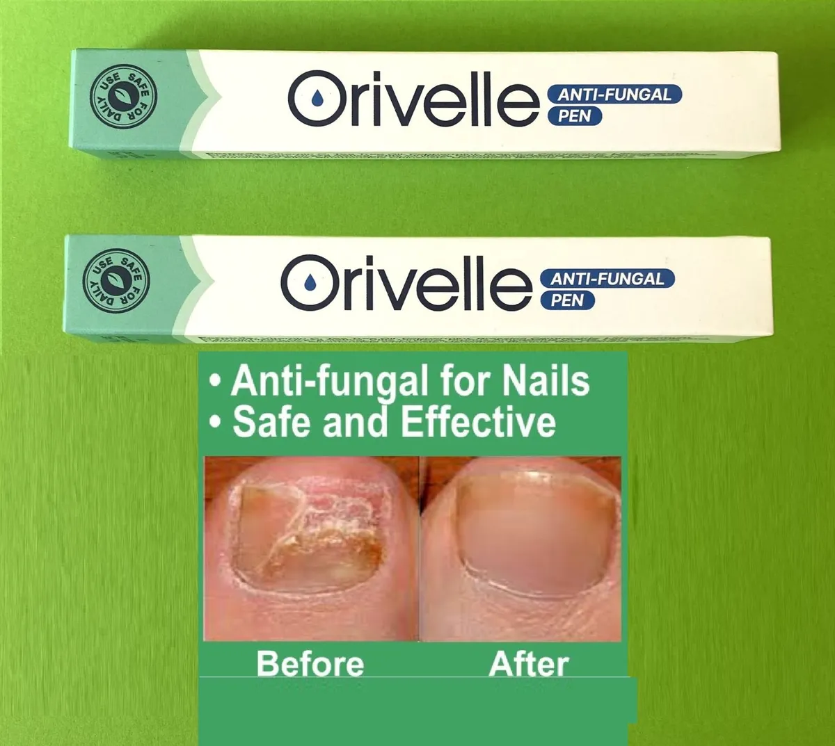 Fungal Nail Care and Repair - Image 2