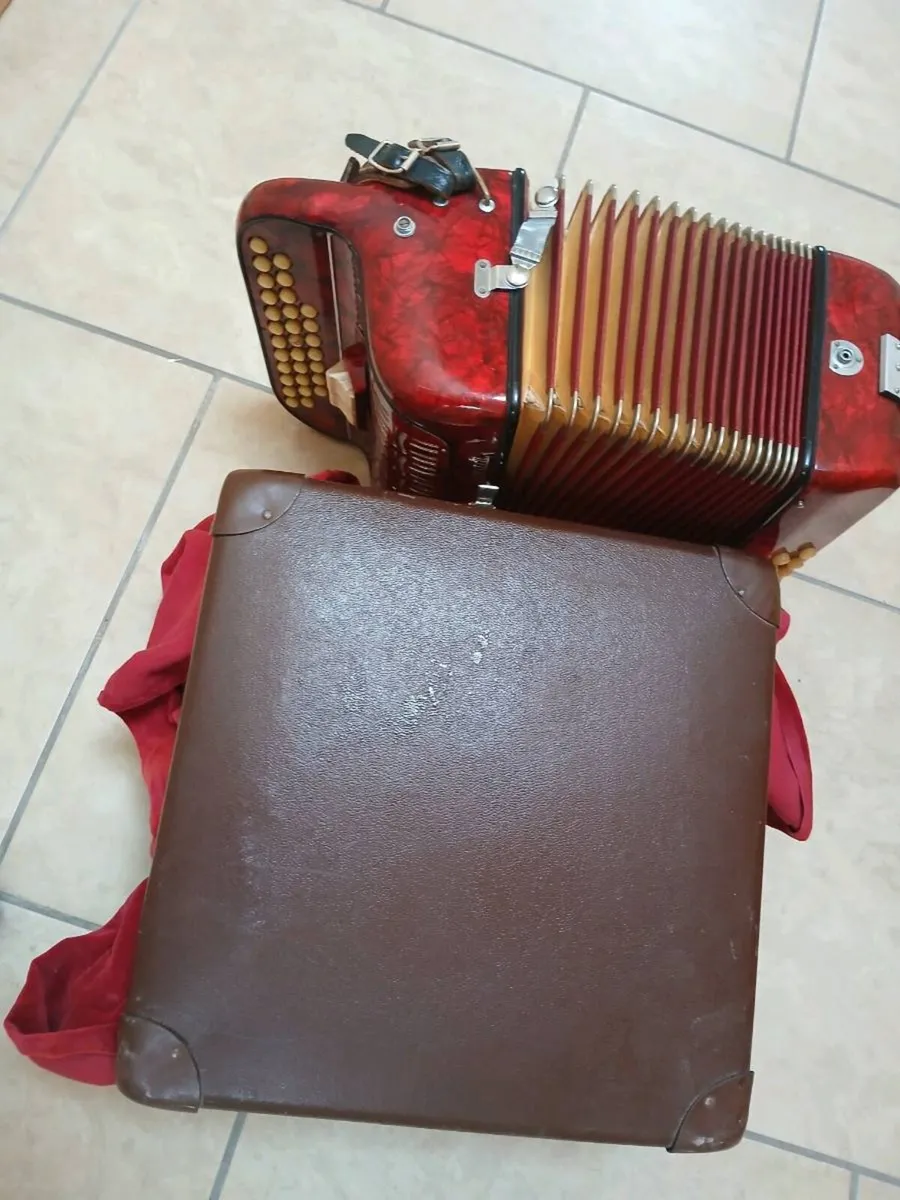 Button  Accordion - Image 4